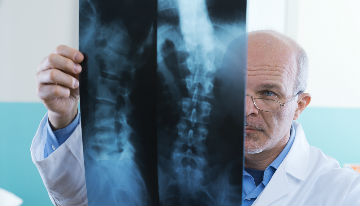 doctor with spinal cord xray