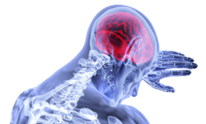 5 Types of Brain Injuries in Georgia